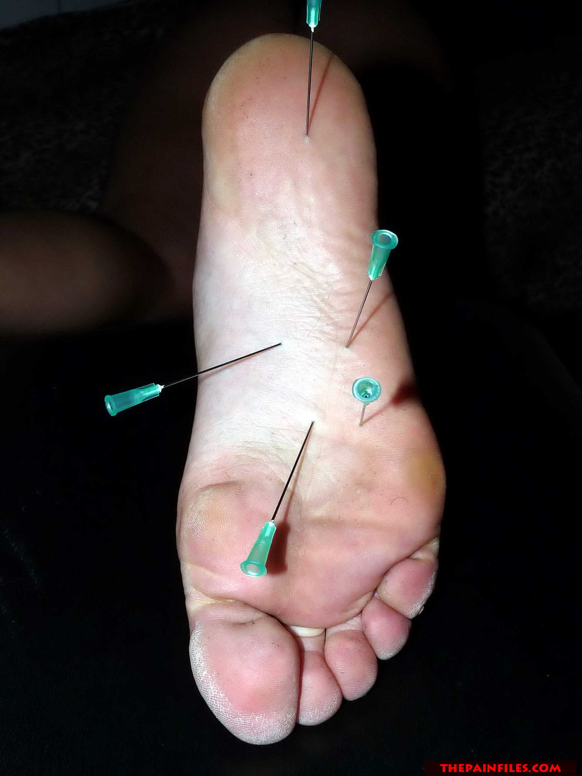 best of Feet needle